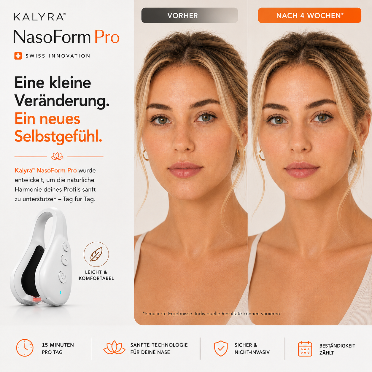 Kalyra® NasoForm Pro